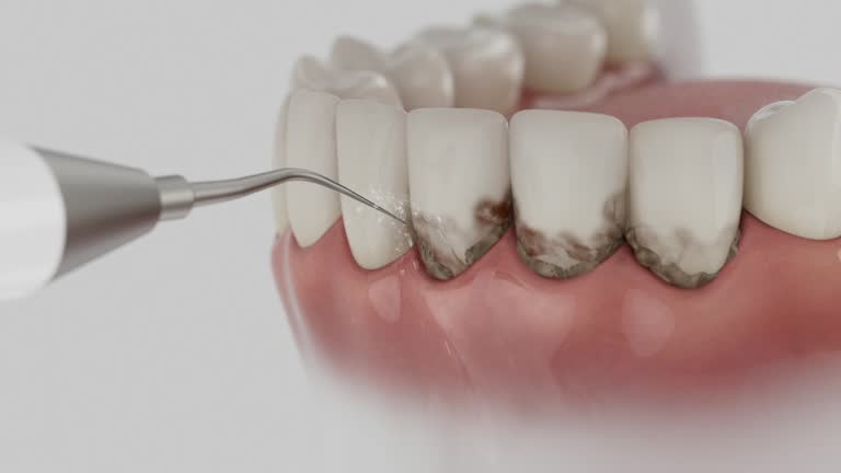 Reliable Dental Implants contractor in Emerson, GA by Smile Center Dentistry